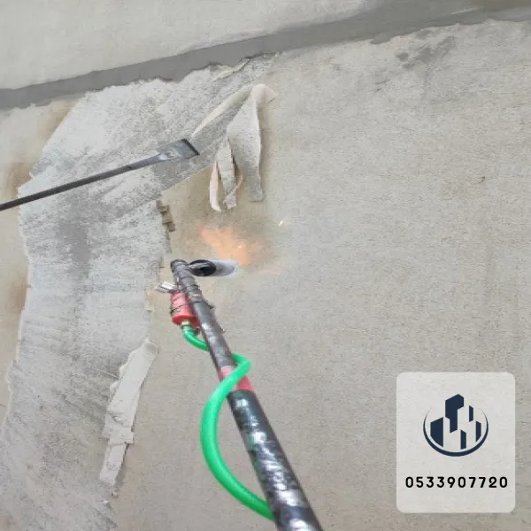 ازاله دهانات