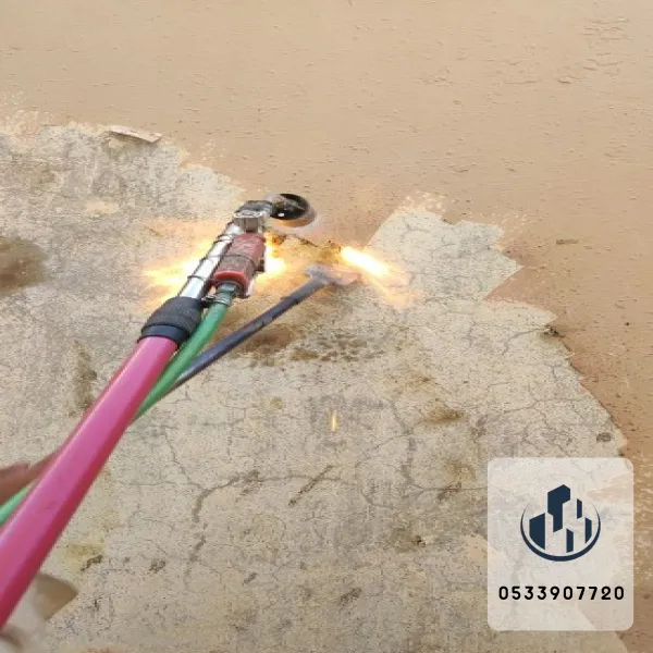 ازاله دهانات