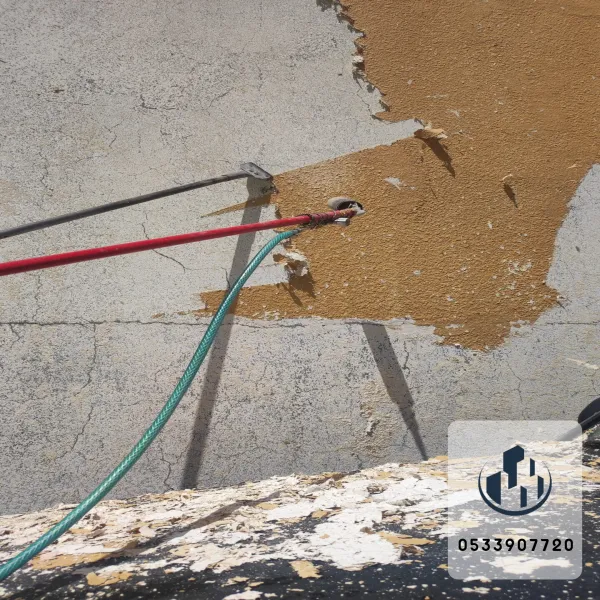 ازاله دهانات