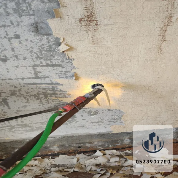 ازاله دهانات