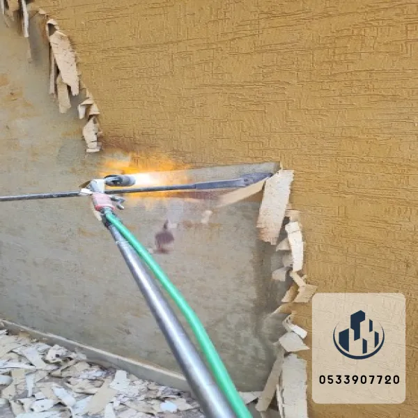 ازاله دهانات